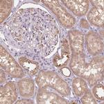 ADH5 Antibody in Immunohistochemistry (Paraffin) (IHC (P))