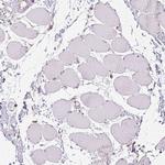 ADH5 Antibody in Immunohistochemistry (Paraffin) (IHC (P))