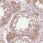 ADH5 Antibody in Immunohistochemistry (Paraffin) (IHC (P))