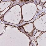 CHMP1B Antibody in Immunohistochemistry (IHC)