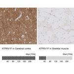 ATP6V1F Antibody in Immunohistochemistry (IHC)