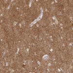 ATP6V1F Antibody in Immunohistochemistry (IHC)