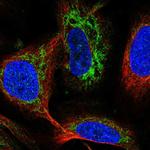 FDX1 Antibody in Immunocytochemistry (ICC/IF)