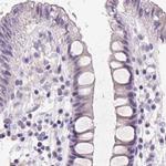 FDX1 Antibody in Immunohistochemistry (IHC)