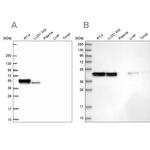 RCN1 Antibody in Western Blot (WB)