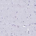 OVGP1 Antibody in Immunohistochemistry (Paraffin) (IHC (P))