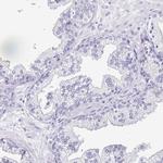 OVGP1 Antibody in Immunohistochemistry (IHC)