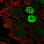 MAGEC2 Antibody in Immunocytochemistry (ICC/IF)