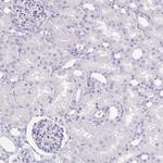 MAGEC2 Antibody in Immunohistochemistry (Paraffin) (IHC (P))