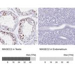 MAGEC2 Antibody