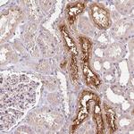 UNC13B Antibody in Immunohistochemistry (Paraffin) (IHC (P))