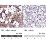 HBQ1 Antibody in Immunohistochemistry (IHC)