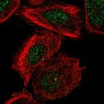 EMC6 Antibody in Immunocytochemistry (ICC/IF)