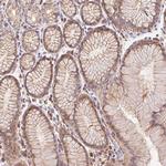 EMC6 Antibody in Immunohistochemistry (Paraffin) (IHC (P))