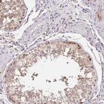 EMC6 Antibody in Immunohistochemistry (Paraffin) (IHC (P))