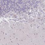 RSL24D1 Antibody in Immunohistochemistry (IHC)