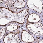 CHMP1B Antibody in Immunohistochemistry (IHC)