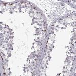 NANOS3 Antibody in Immunohistochemistry (IHC)