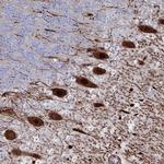 OR2T1 Antibody in Immunohistochemistry (Paraffin) (IHC (P))