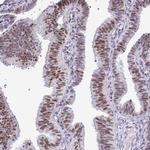 IRF1 Antibody in Immunohistochemistry (Paraffin) (IHC (P))