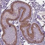 CLN3 Antibody in Immunohistochemistry (Paraffin) (IHC (P))