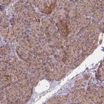 Adenylate Kinase 3 Antibody in Immunohistochemistry (IHC)