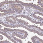 RPS3 Antibody in Immunohistochemistry (Paraffin) (IHC (P))