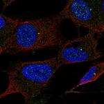 UBE2Q1 Antibody in Immunocytochemistry (ICC/IF)