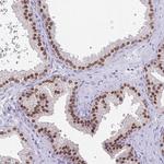 UBE2Q1 Antibody in Immunohistochemistry (Paraffin) (IHC (P))