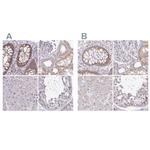 RSL24D1 Antibody in Immunohistochemistry (IHC)