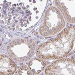 RSL24D1 Antibody in Immunohistochemistry (IHC)