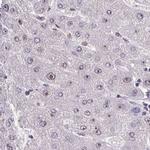 RSL24D1 Antibody in Immunohistochemistry (IHC)