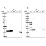 RSL24D1 Antibody in Western Blot (WB)