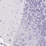 ST8SIA3 Antibody in Immunohistochemistry (Paraffin) (IHC (P))