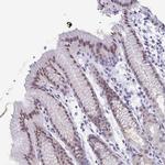 PYCRL Antibody in Immunohistochemistry (Paraffin) (IHC (P))