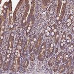 MAN1A1 Antibody in Immunohistochemistry (IHC)