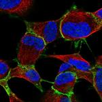 ARVCF Antibody in Immunocytochemistry (ICC/IF)