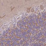 ARVCF Antibody in Immunohistochemistry (Paraffin) (IHC (P))