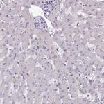 ARVCF Antibody in Immunohistochemistry (Paraffin) (IHC (P))