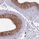 ARVCF Antibody in Immunohistochemistry (IHC)