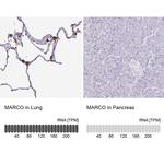 MARCO Antibody in Immunohistochemistry (IHC)