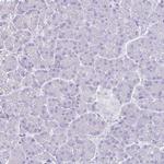 MARCO Antibody in Immunohistochemistry (IHC)