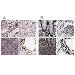 ZNF207 Antibody in Immunohistochemistry (IHC)