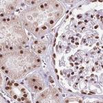 ZNF207 Antibody in Immunohistochemistry (IHC)