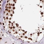 ZNF207 Antibody in Immunohistochemistry (IHC)