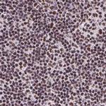 ZNF207 Antibody in Immunohistochemistry (IHC)