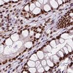 ZNF207 Antibody in Immunohistochemistry (IHC)