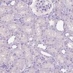 SLC35C1 Antibody in Immunohistochemistry (Paraffin) (IHC (P))