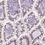 SLC35C1 Antibody in Immunohistochemistry (IHC)