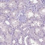 SLC35C1 Antibody in Immunohistochemistry (IHC)